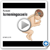 08 Myelomeningocoele