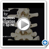 07 Interspinous Stabilization of the Spine